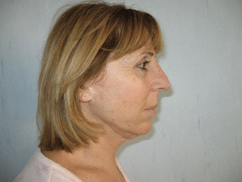 Chiudi