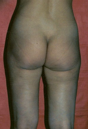 Chiudi