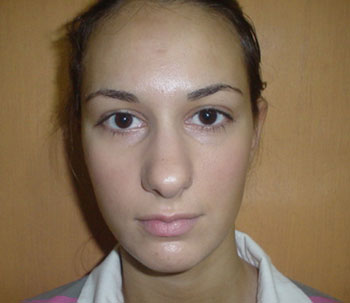 Chiudi