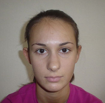 Chiudi