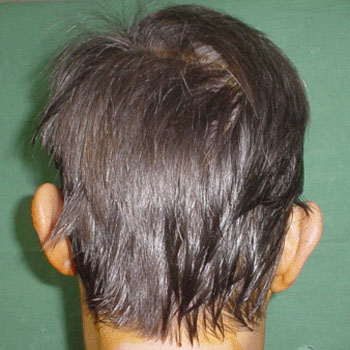Chiudi