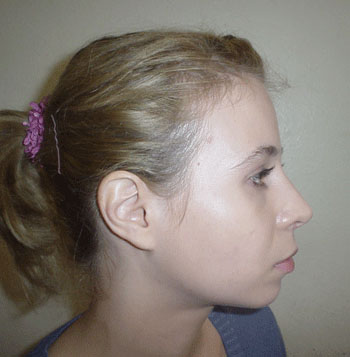 Chiudi
