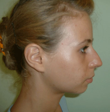 Chiudi