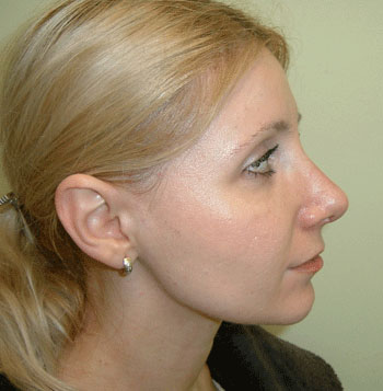 Chiudi