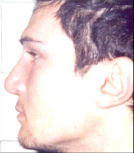 Chiudi