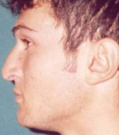 Chiudi